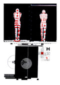 Print of Translimit 1